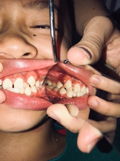 GƯƠNG CHỈNH NHA