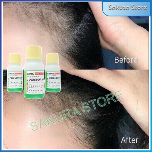 Tinh chất kích thích mọc tóc thảo dược Sato Nhật Bản 30ml giúp tóc chắc khỏe