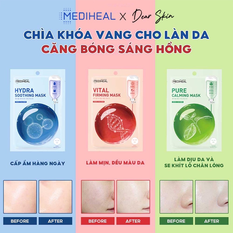 [Chính hãng] Mặt nạ Mediheal giấy cấp ẩm, dưỡng trắng, làm dịu da, loại bỏ bã nhờn và cung cấp dưỡng chất cho da