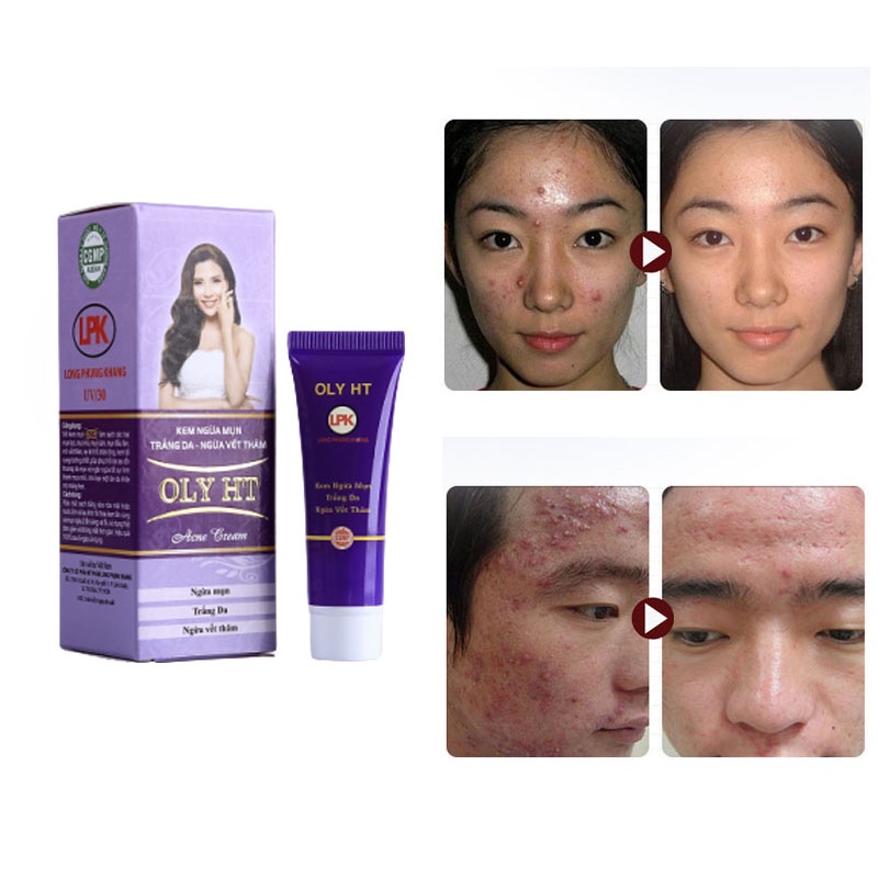 Kem ngừa mụn dưỡng trắng da ngừa vết thâm OLY HT hàng chính hãng Long Phụng Khang