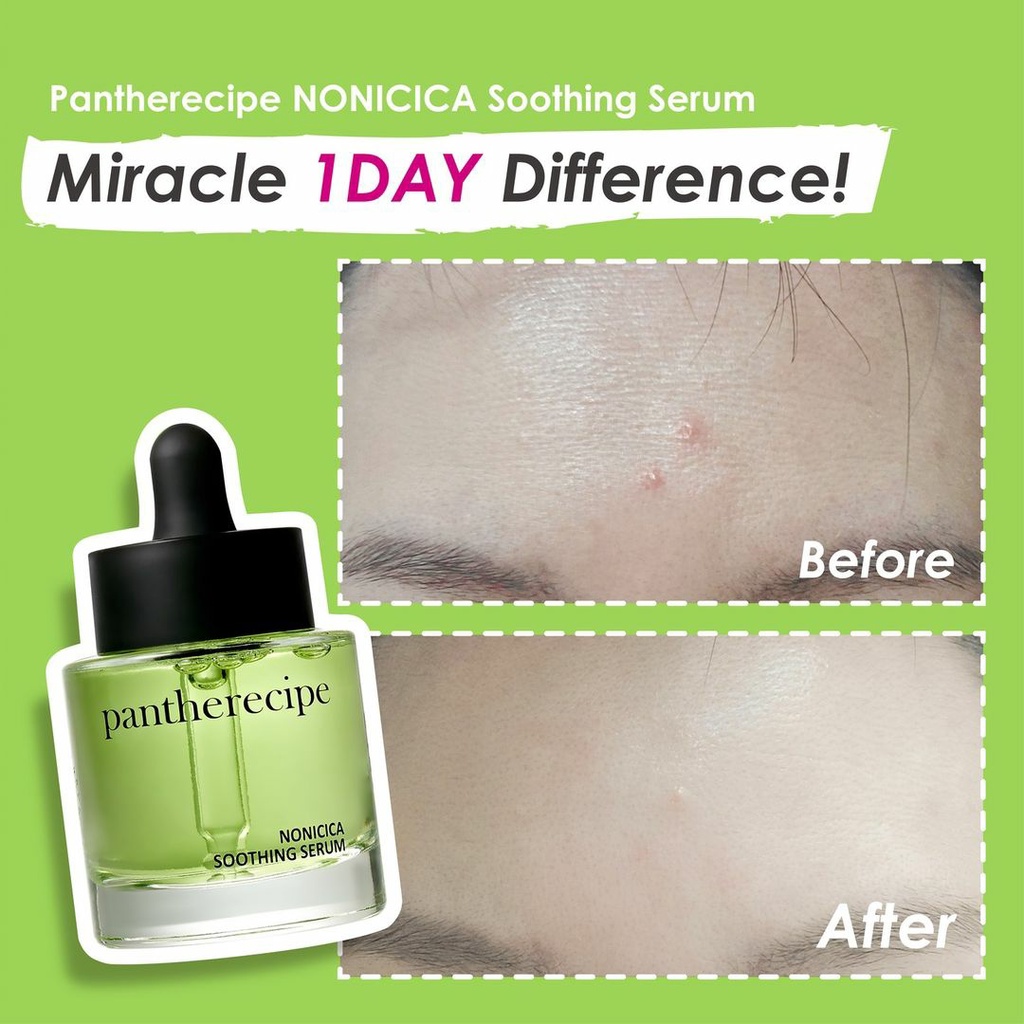 Tinh chất rau má noni PESTLO PANTHERECEIPE NONICICA SOOTHING SERUM