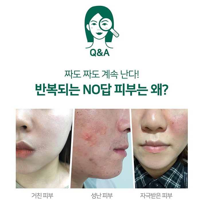 SERUM &amp; KEM DƯỠNG SOME BY MI AHA-BHA-PHA 30 DAYS MIRACLE CREAM 50ML