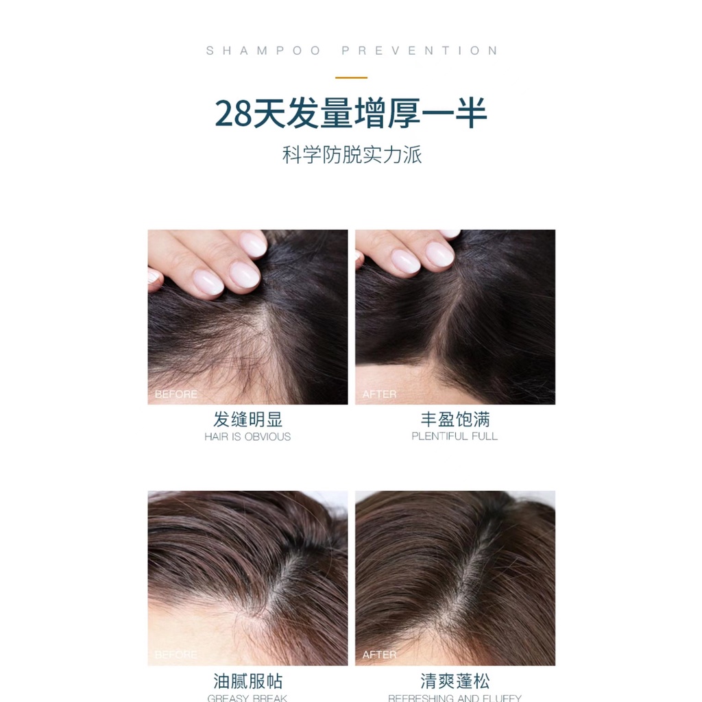 Dầu Gội Đầu Sma EHD Nuôi Dưỡng Chân Tóc Mềm Mượt Chống Gàu Cho Nam Nữ