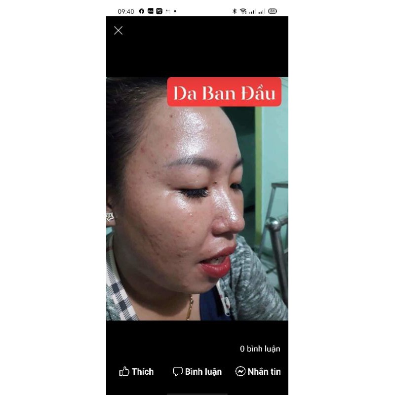 Kem face VIP thượng hạng cho da hư tổn