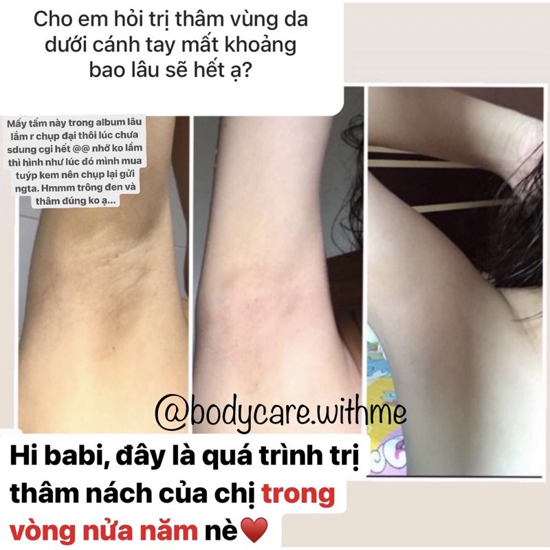 GEL dưỡng trắng, ngừa thâm Gluta-C