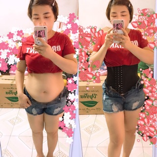 Đai nịt bụng Latex nhập khẩu từ Hy Lạp