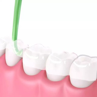Dụng Cụ Tháo Niềng Trong Suốt Invislign