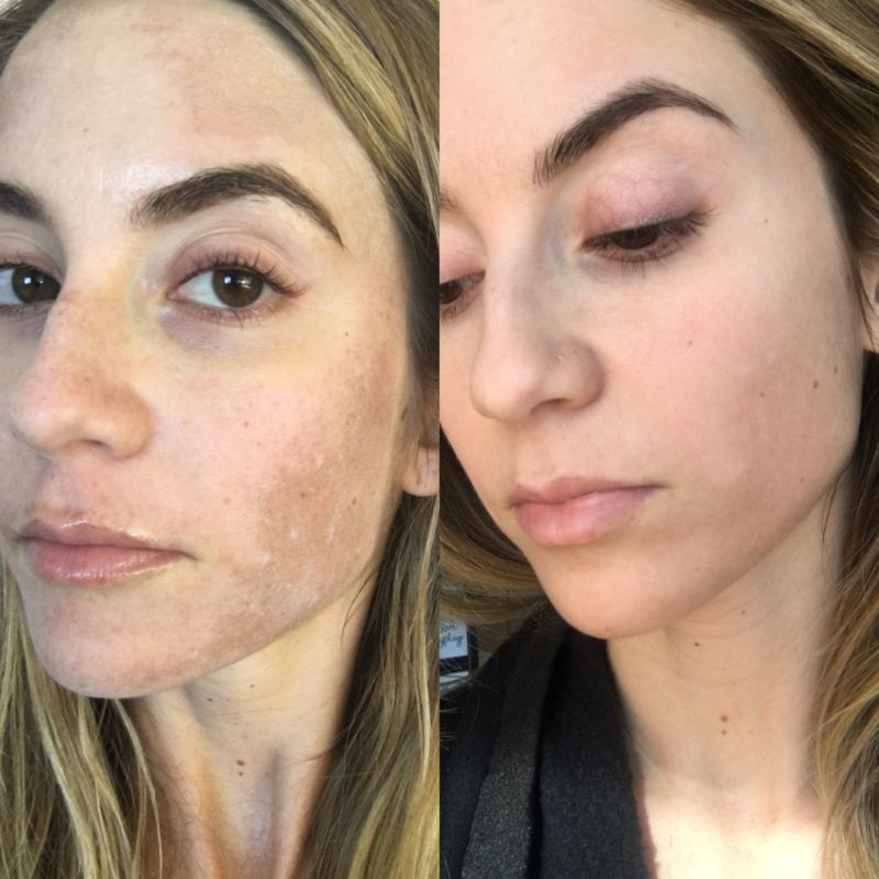 Tinh chất Liposomal Glutathione 1500mg Trắng Da Chống Lão Hóa Starhonor