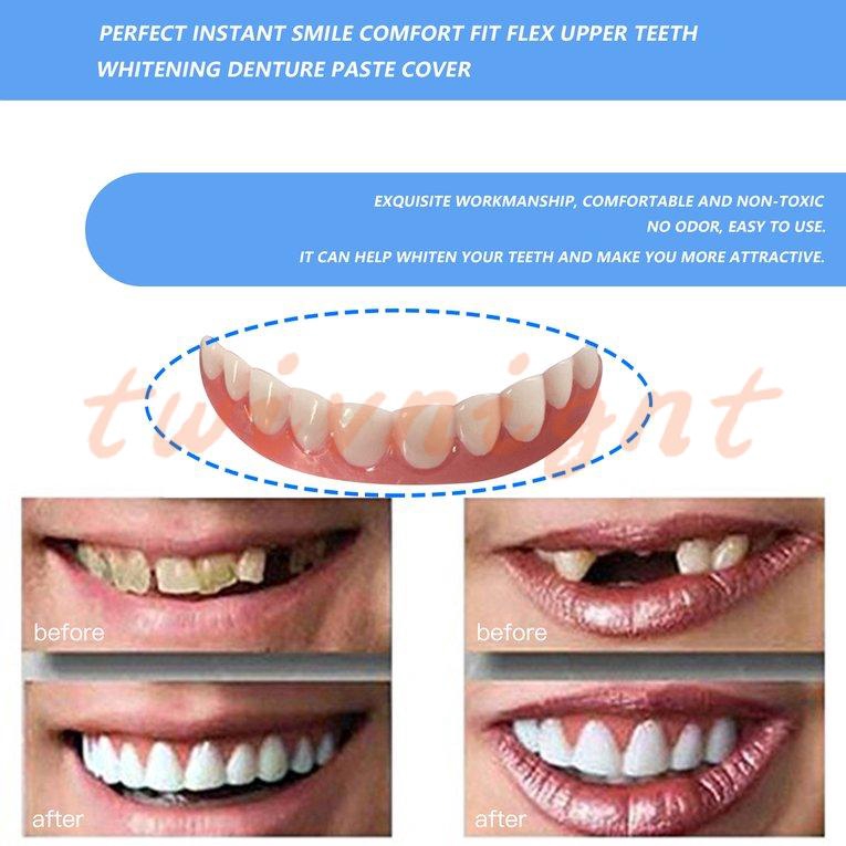 Răng giả dán hàm trên làm trắng vừa vặn thoải mái tạo nụ cười hoàn hảo nhanh chóng