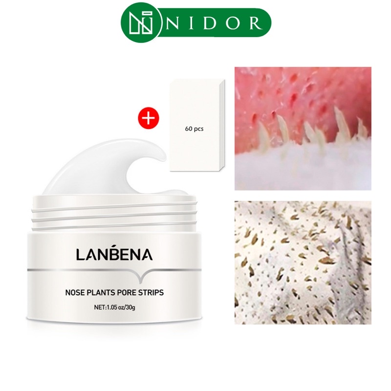 Mặt nạ LANBENA loại bỏ mụn đầu đen cho mũi và mặt hiệu quả 30g