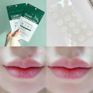 Miếng Dán Mụn Tràm Trà Some By Mi Clear Spot Patch 18 Miếng