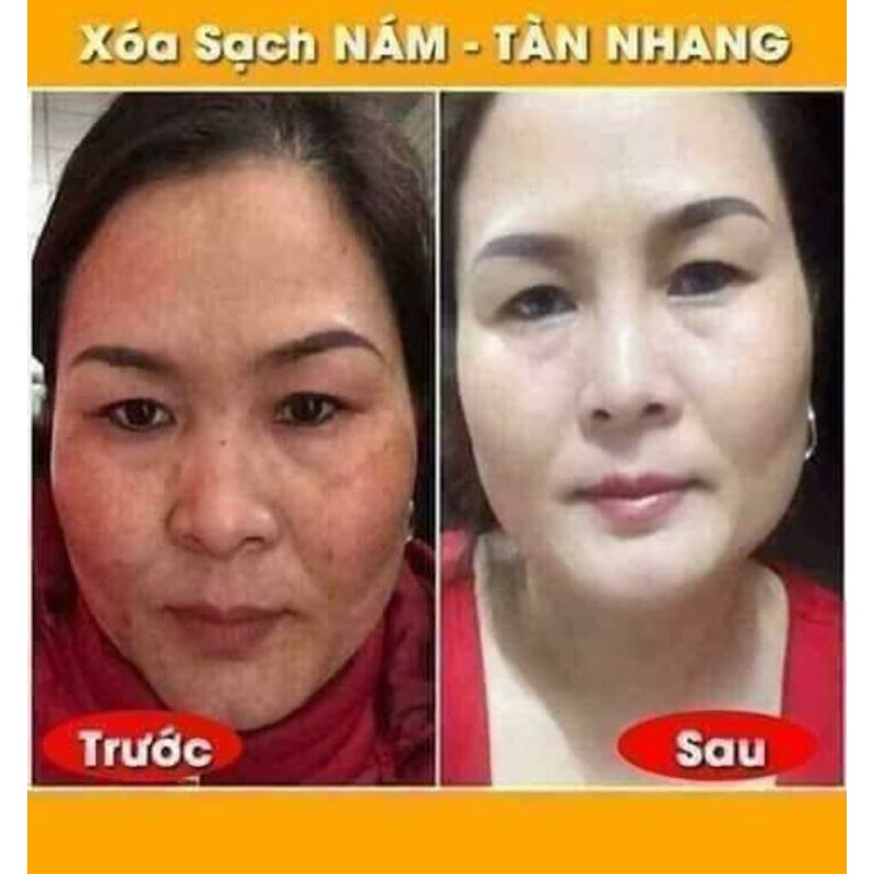 KEM NÁM  CLOBETAMIL G