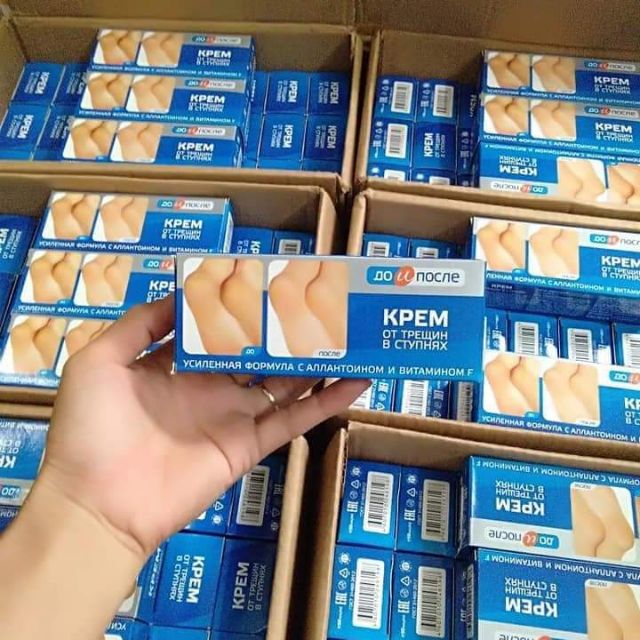 Kem trị nứt gót chân Kpem _ Nga