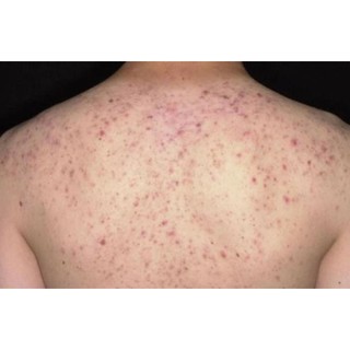 Muối Thảo Mộc Biocos