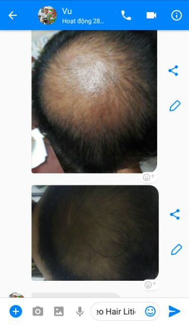 Neo Hair Lotion (Chuyên sỉ)