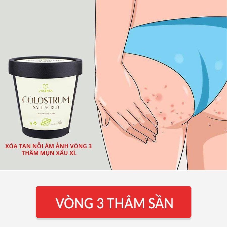 Muối Tắm Tinh Chất Sữa Non Lasenta Hết Mụn Lưng, Viêm Nang Lông