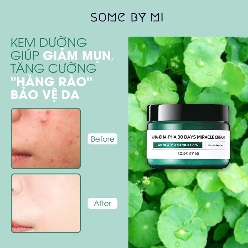 Kem Dưỡng Giảm Mụn Some By Mi AHA-BHA-PHA 30 Days Miracle Cream 60g