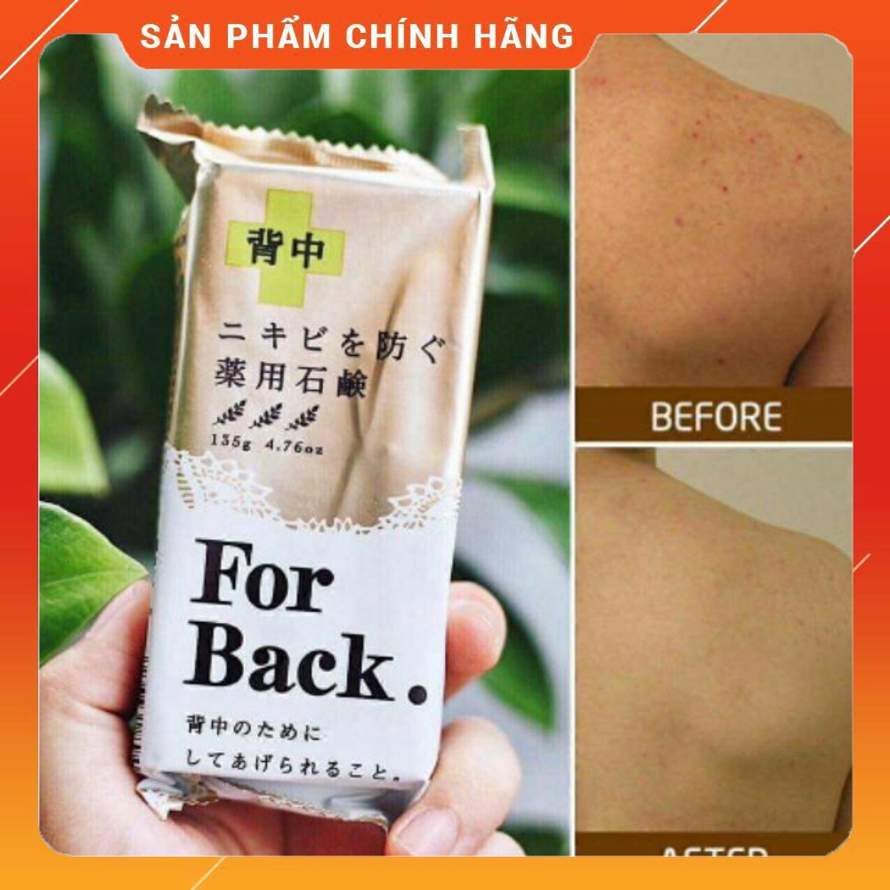 Xà bông cục kháng mụn lưng Forback Nhật Bản (chính hãng)