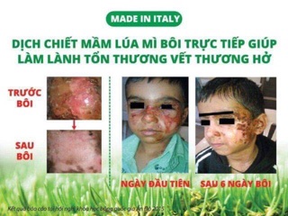 Gel Fitostimoline Proctogel (hàng chính hãng Ý)(làm lành vết thương hở...)