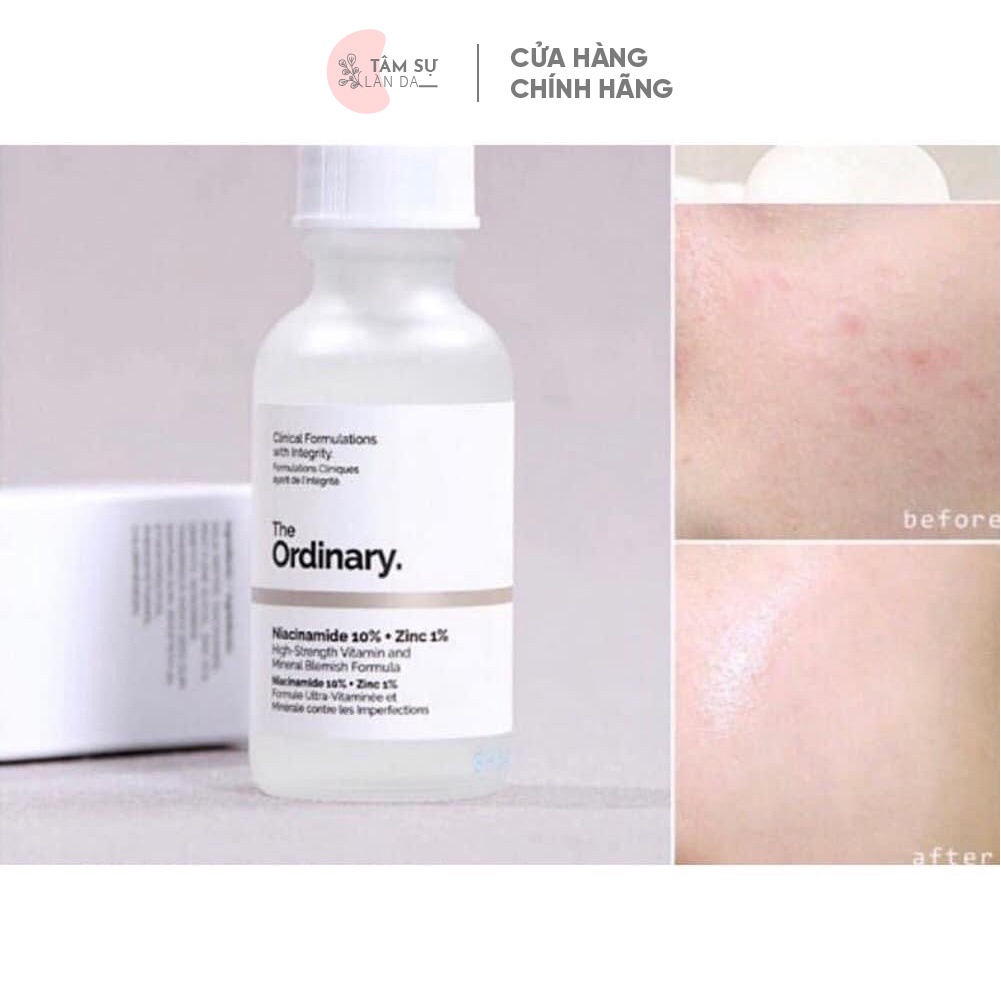 Serum The Ordinary Niacinamide 10% + Zinc 1% Giúp Cân Bằng Bã Nhờn Làm Sáng Da Thu Nhỏ Lỗ Chân Lông 30ml