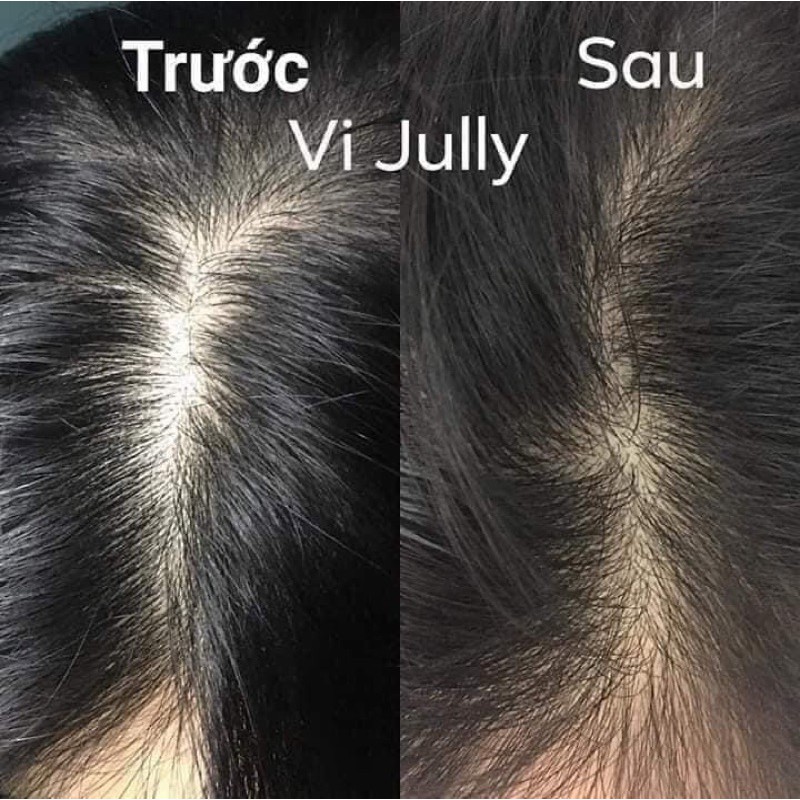 [TẶNG CỘT TÓC] Tinh Dầu Bưởi Kích Mọc Tóc Nhanh- Giảm Rụng Tóc- Làm Dài và Dày Tóc- Nuôi Dưỡng Chân Tóc Chắc Khoẻ | BigBuy360 - bigbuy360.vn