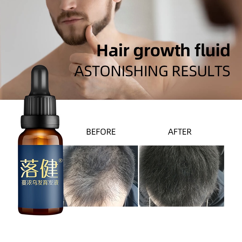 Tinh chất kích thích mọc tóc KOPYRROL minoxidil bản nâng cấp 30ml chuyên dụng cho tóc/lông mày mọc dày và khỏe hơn