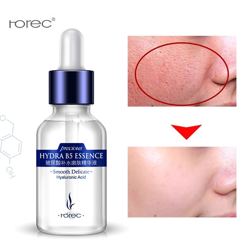 Tinh chất ROREC Axit Hyaluronic chăm sóc sâu cho da ngừa lão hóa làm căng da xóa nếp nhăn se khít lỗ chân lông 15ml