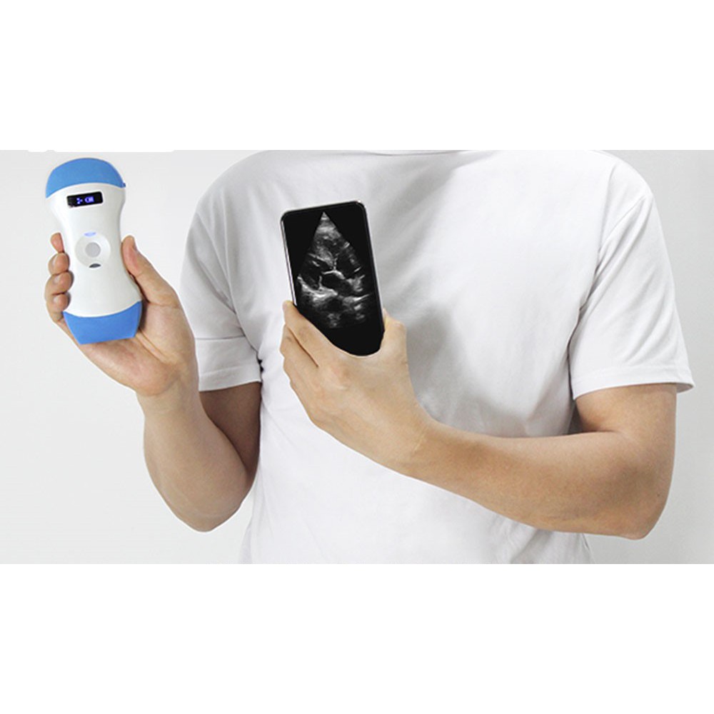 Thiết bị siêu âm không dây tích hợp 3 loại đầu dò bảo hành chính hãng 12 tháng