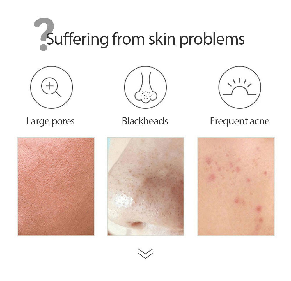 (Hàng Mới Về) Mặt Nạ Salicylic Acid Han Lunmeiyu Thu Nhỏ Lỗ Chân Lông Trị Mụn Trứng Cá | BigBuy360 - bigbuy360.vn