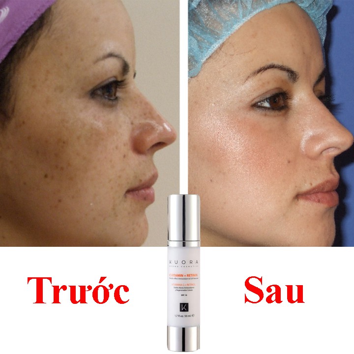 Kem Xóa Nám, MờThâm, Làm Sáng và Đều Màu Da  💓 RETINOL & VITAMIN C 💓 Mỹ Phẩm Cao Cấp Châu Âu | BigBuy360 - bigbuy360.vn