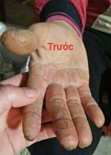 MỠ TRĂN NGUYÊN CHẤT N’STORE