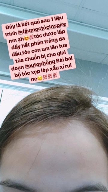 Tinh chất kích thích mọc tóc Inspire Hair Growth Tonic