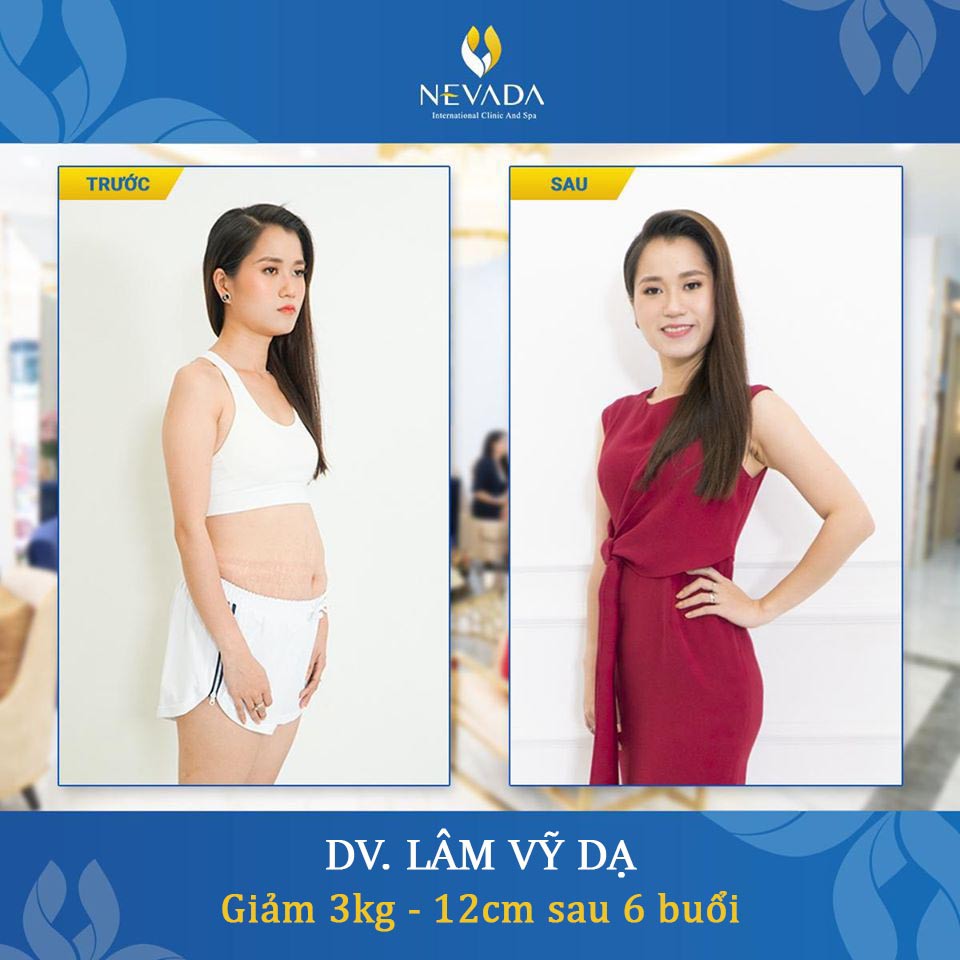 Hà Nội - Hồ Chí Minh [E-Voucher] Giảm Béo Công Nghệ Cao Max Burn Lipotech 2020 Tại TMV Nevada