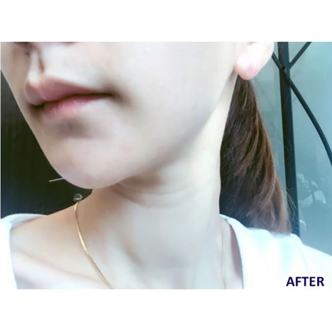 Kem Loại Bỏ Tế Bào Chết Làm Mềm Da Chứa 5% AHA Paula's Choice Resist Daily Smoothing Treatment With 5% AHA 50ml