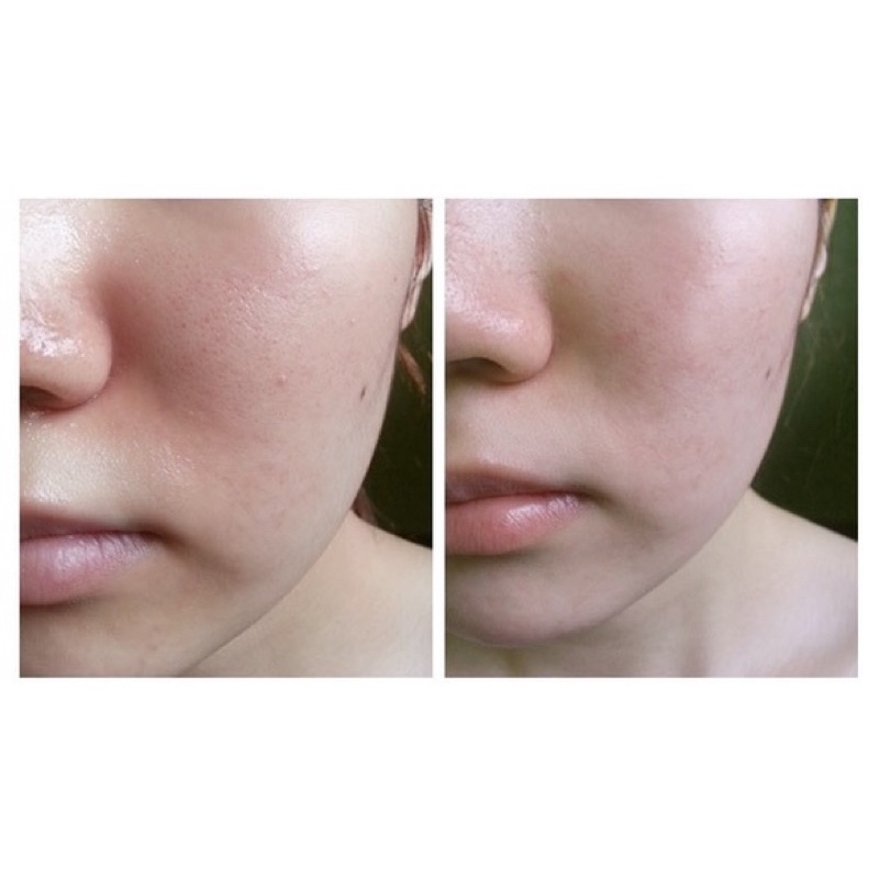 Sữa rửa mặt sạch sâu cho da dầu mụn Manyo Purifying Soda Foam