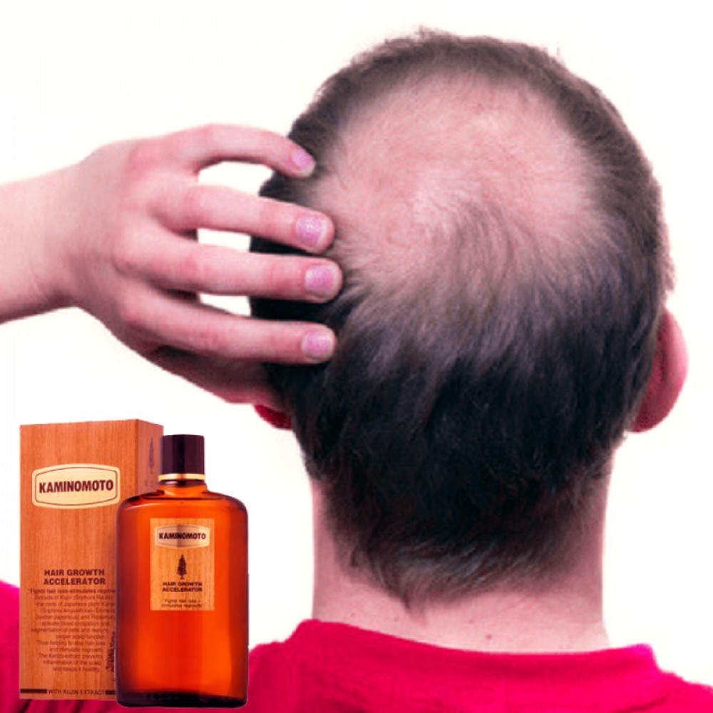 DẦU GỘI KÍCH THÍCH MỌC TÓC KAMININOTO HAIR GROWTH TONIC