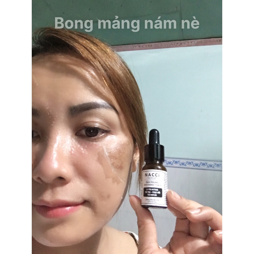 Peel lột da mặt vi tảo chuyên SPA - Thay da sinh học vi tảo cho mặt - tẩy da chết mặt cao cấp