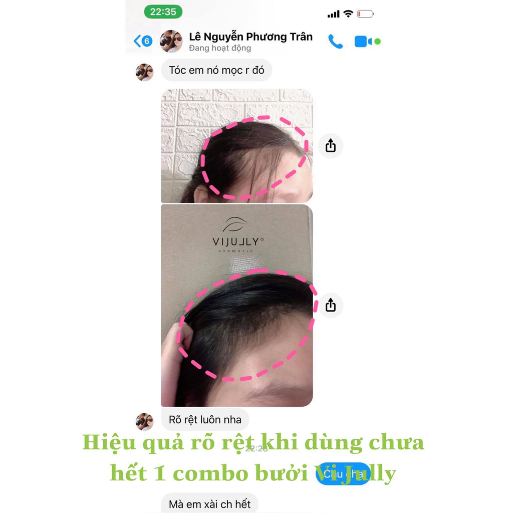 [NGĂN RỤNG-DÀY TÓC]  Bộ Dầu Gội Bưởi - Tinh Dầu Bưởi Vi Jully Ngăn Ngừa Rụng - Phục Hồi Tóc Hư Tổn Mọc Tóc | BigBuy360 - bigbuy360.vn