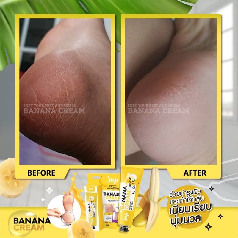 01 Tuýp Giảm Nứt Gót Dưỡng Da Chân Joji Banana Cream 50g