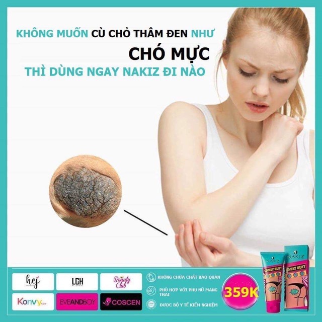 3 TUÝP NAKIZ LIVELY BUTT 〡 Kem thoa thâm Mông, Bẹn, Nách, Lưng, Nhũ hoa, Đầu gối, Cùi chỏ.... Thái Lan | BigBuy360 - bigbuy360.vn