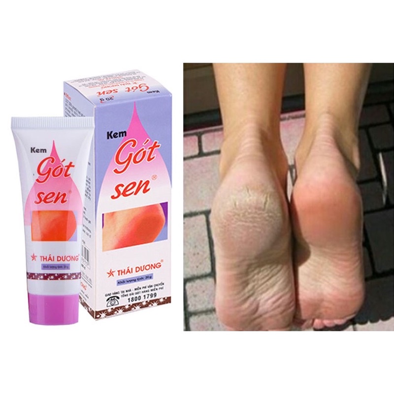 Kem nẻ Gót Sen
