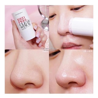 [ FREE SHIP] Thanh lăn mụn đầu đen red peel clear sitck