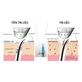 Gel nâng cơ Galvanic ( BÁN LẺ 1 CẶP)