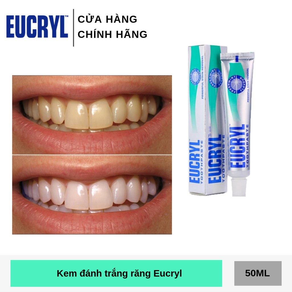 Kem Đánh Răng Tẩy Trắng Eucryl Toothpaste 62g Bột trắng răng  Anh Quốc Chính hãng