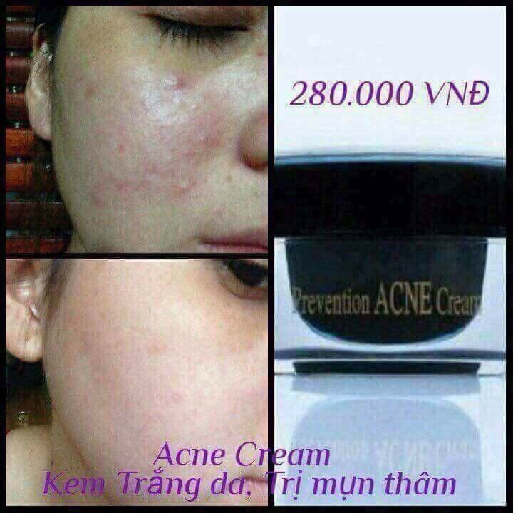 Kem Ngăn Ngừa Mụn Acne Dr Cell