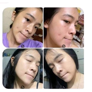 [Chính Hãng] Thảo Mộc Xanh 5ml
