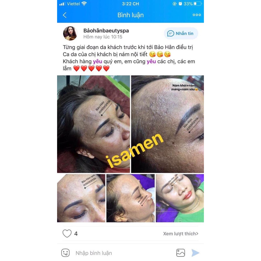 [TẶNG MẶT NẠ] Thải độc tố Detoshi plus tái tạo làn da mới, giảm mụn ẩn mụn cám, se khít lỗ chân lông | BigBuy360 - bigbuy360.vn