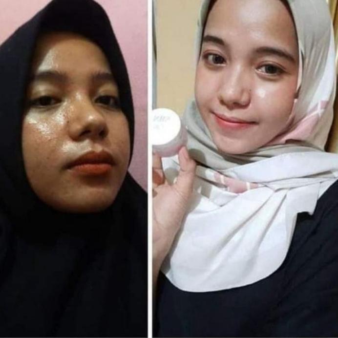 ✨Giảm giá?Giảm giá⚡ Nbs SKINCARE ULTIMATE | Mặt nạ dưỡng da | An toàn cho BUSUI & Earth | BigBuy360 - bigbuy360.vn