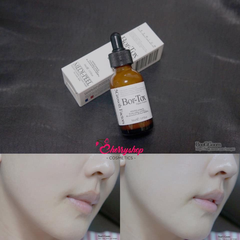 BỘ DƯỠNG Căng Mượt Làm chậm quá trình Lão Hóa MEDI PEEL BORTOX PEPTIDE