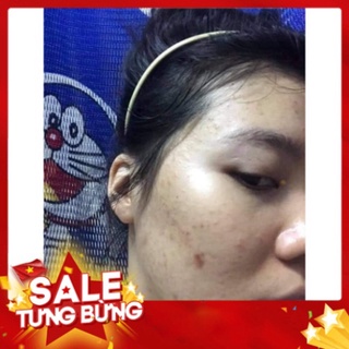Combo tri mun Dr mai [CHÍNH HÃNG] ✅